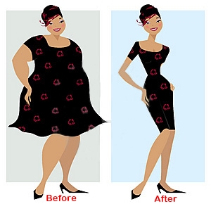 weight loss surgery in India
